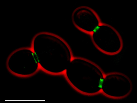 Saccharomyces cerevisiae cells under the microscope. A single healthy pitch contains billions of these; keeping them healthy and uncontaminated is the brewer's central responsibility.